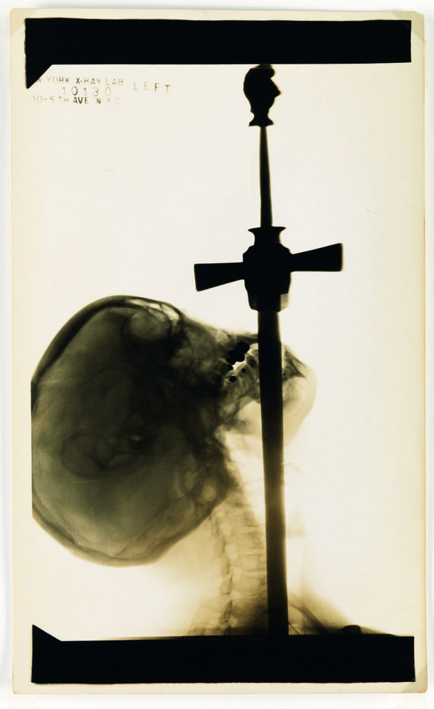 Down the Hatch: “Mighty Ajax” awed crowds by swallowing swords that he first plunged into flames. Would-be emulators died attempting his act. An x-ray reveals Ajax’s talent. (Courtesy Swann Auction Galleries)