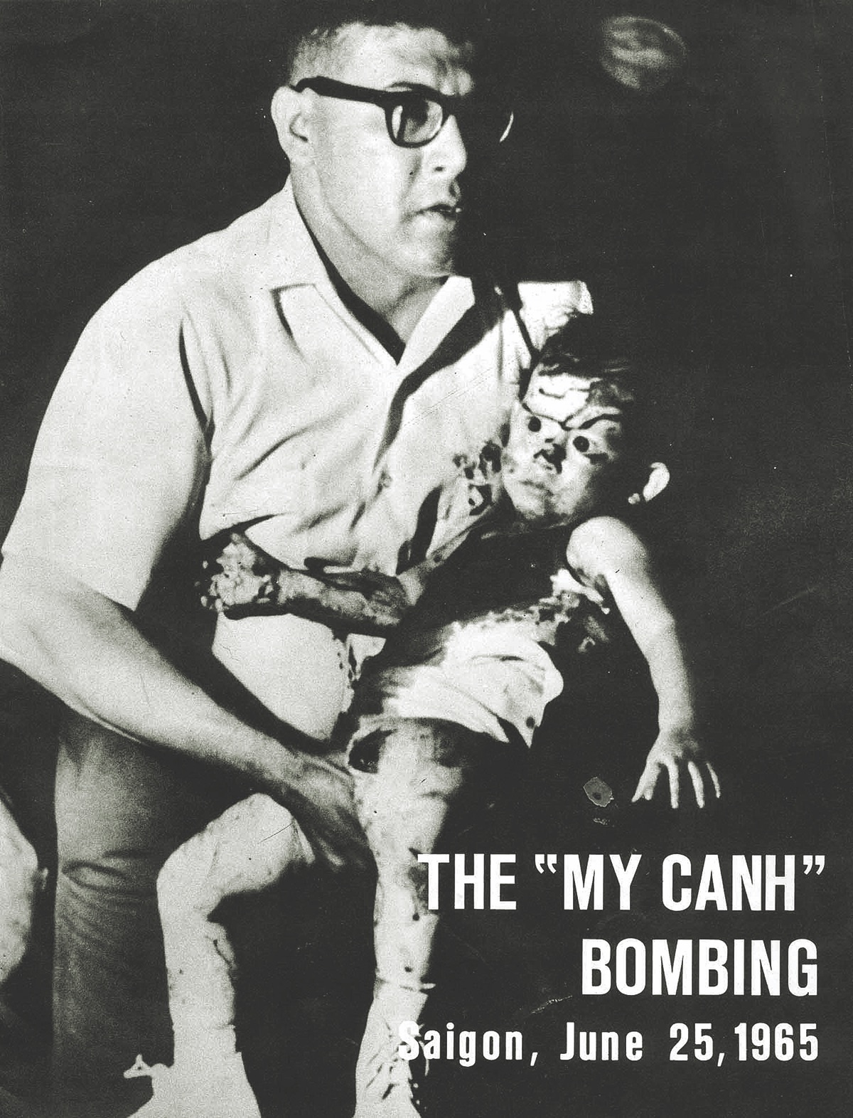 To draw attention to the brutality of the bombing, the U.S. government’s public affairs office in Saigon published a pamphlet of pictures showing the savageness of the attack on the restaurant. The My Cahn child, misidentified as a boy, was on the cover. (Joint U.S. Public Affairs Office)