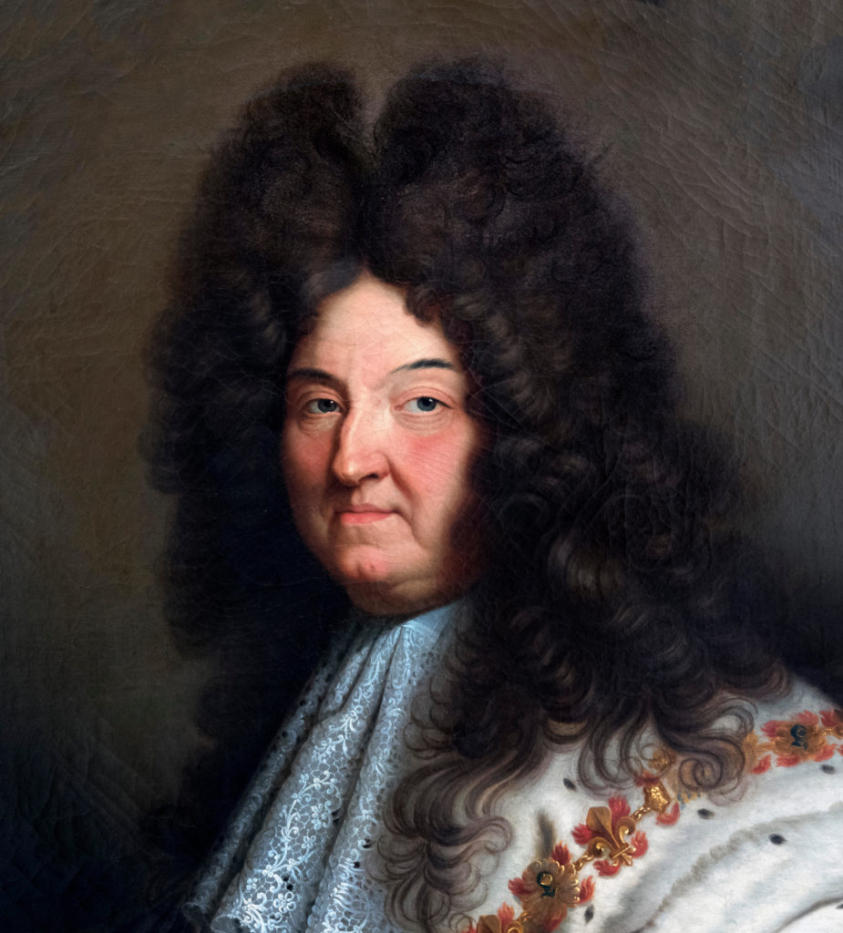 Shaved Heads and Syphilis A Brief History of Wigs